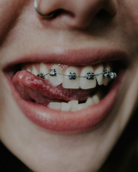 Blogs thumbnail Image