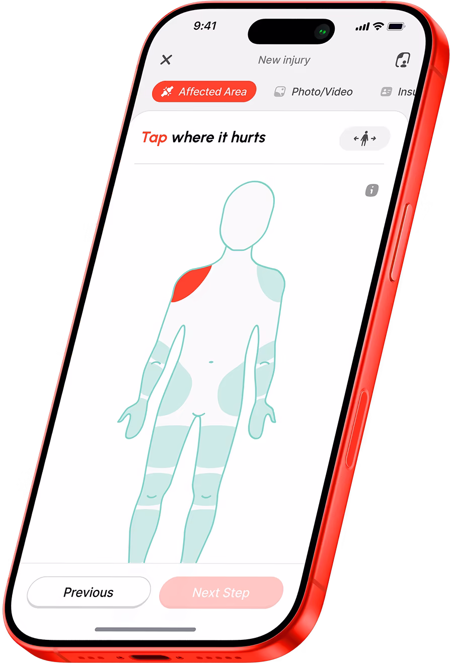 Mobile app screen showing a pain mapping feature with a body outline highlighting left shoulder in red under 'Affected Area' tab.