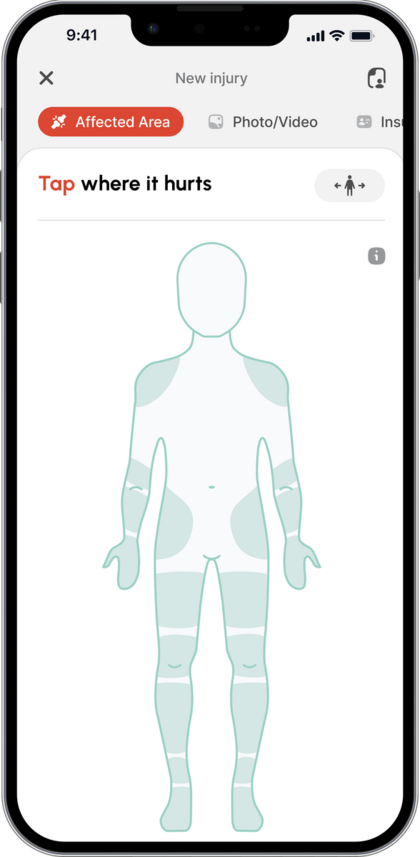 The HURT! app showing the Tap where it hurts body map