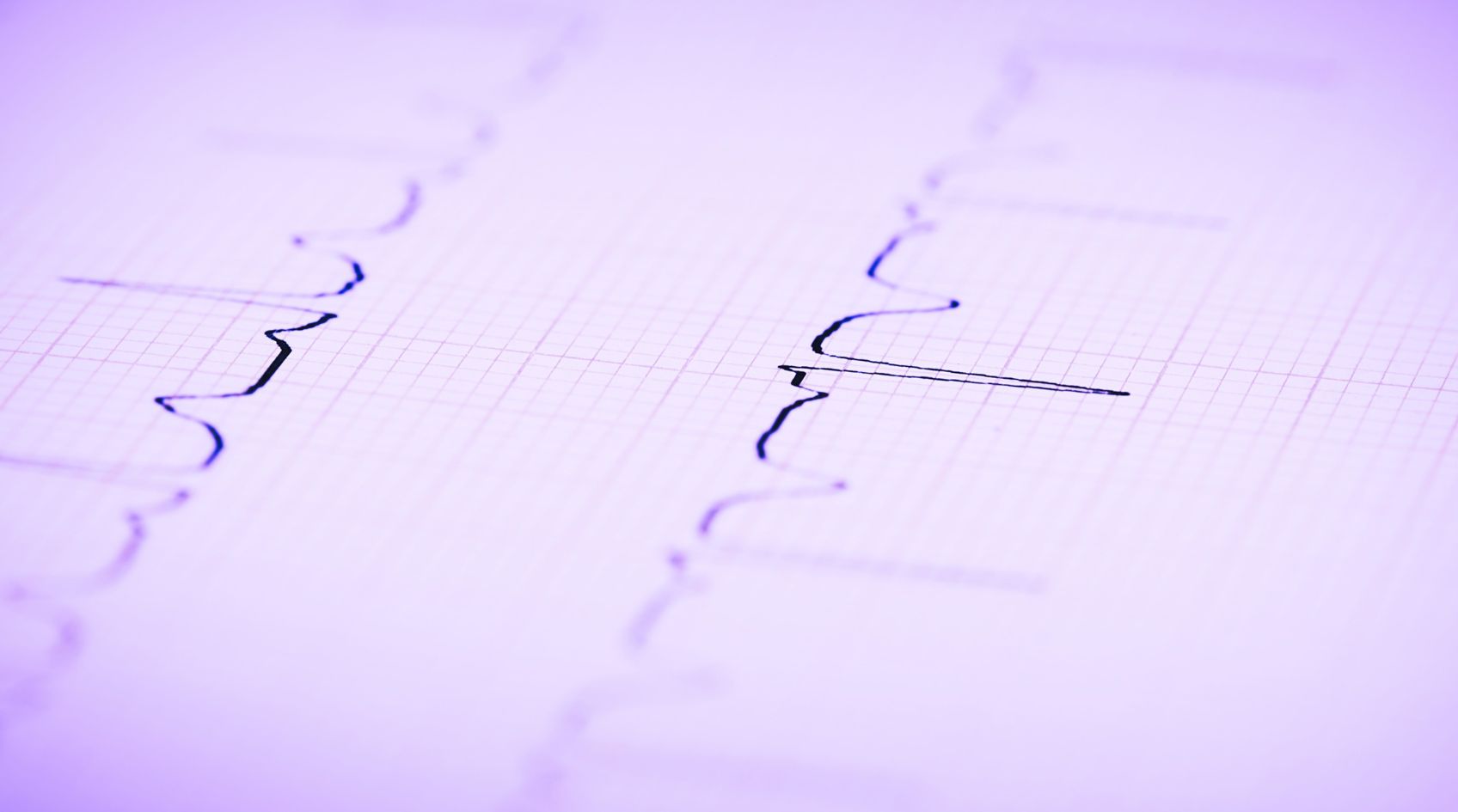 Prendre soin des recruteurs n'est pas facultatif, c’est urgent