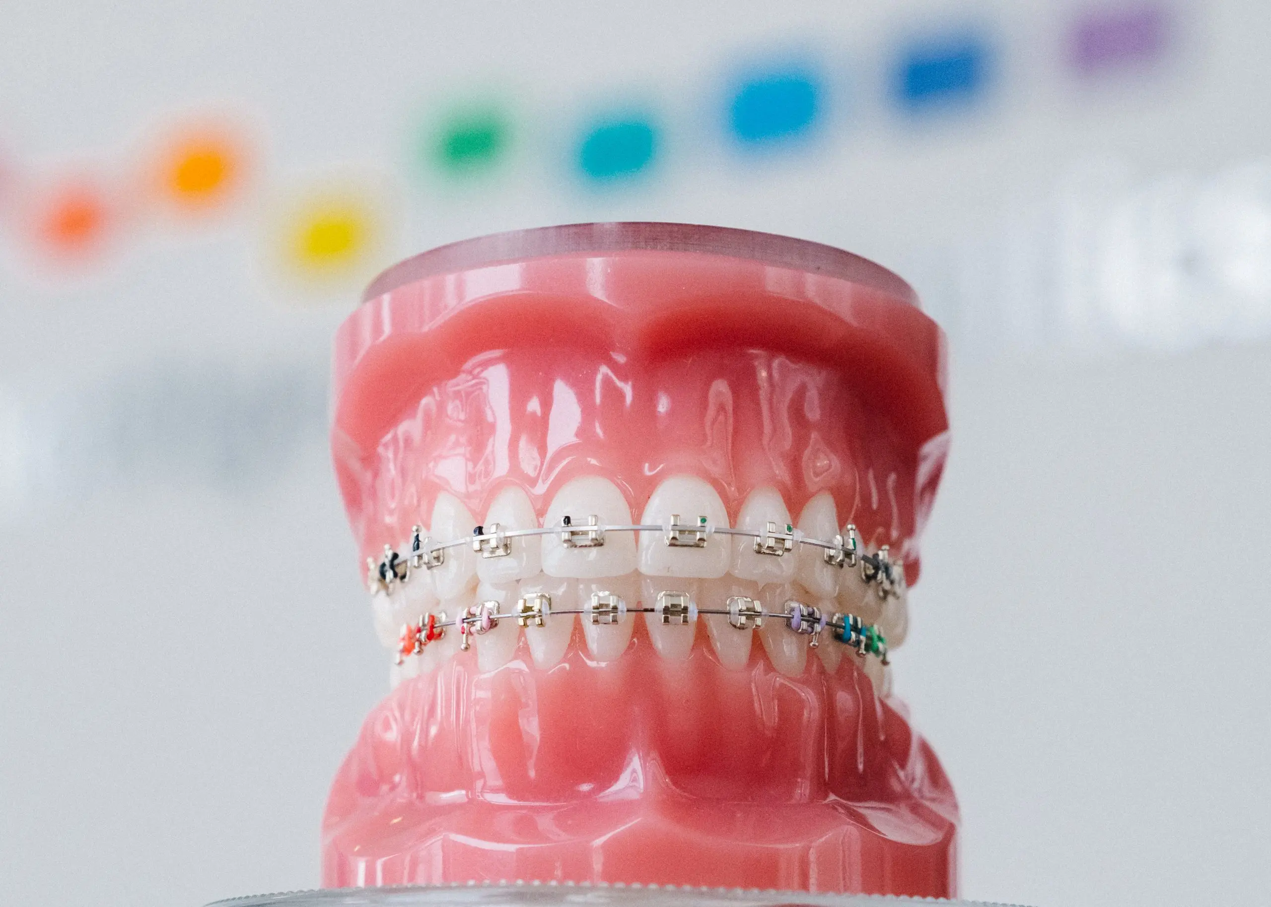 Dental model showing teeth with colorful braces on upper and lower teeth.