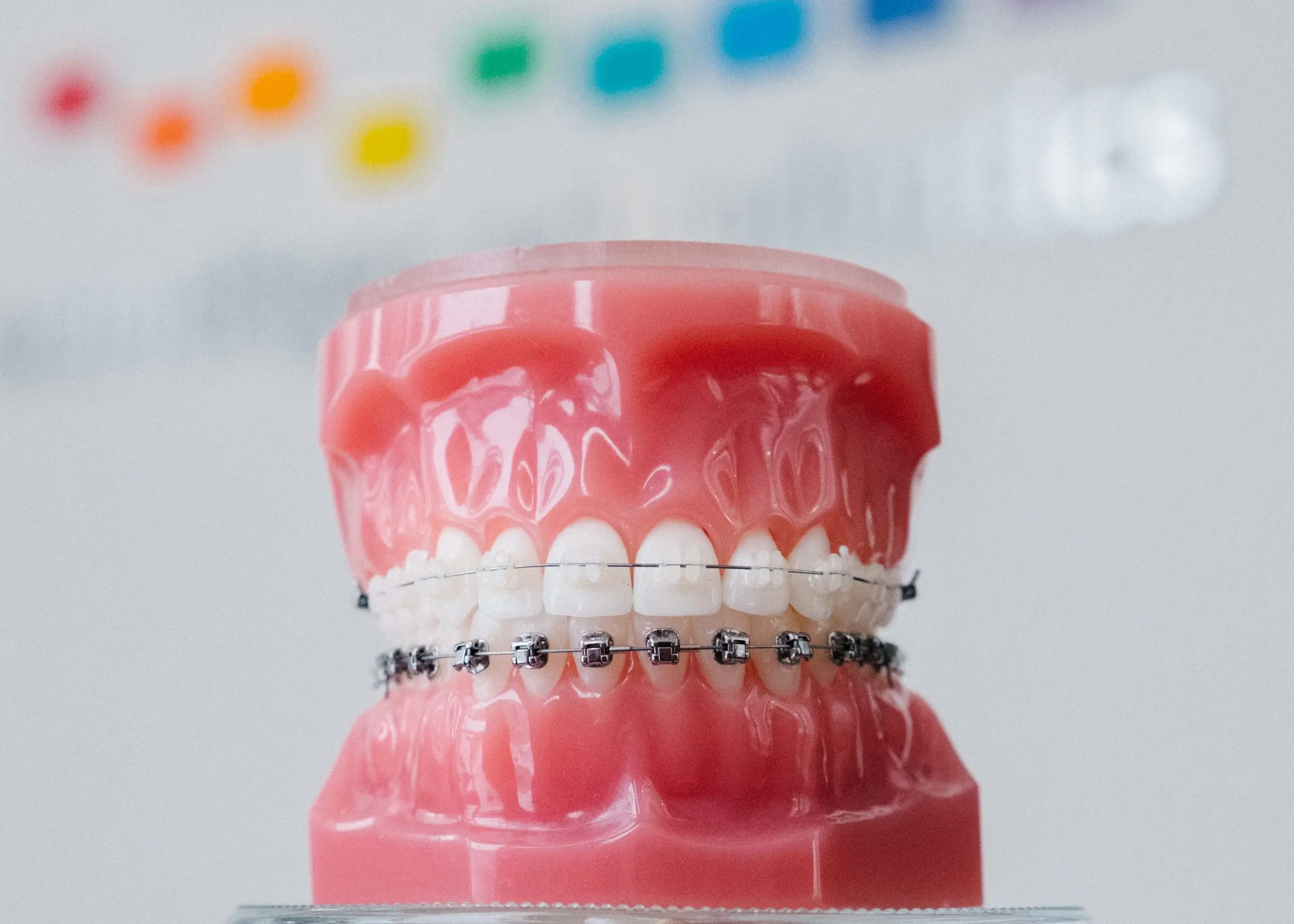 Dental model showing both clear and metal braces on teeth.