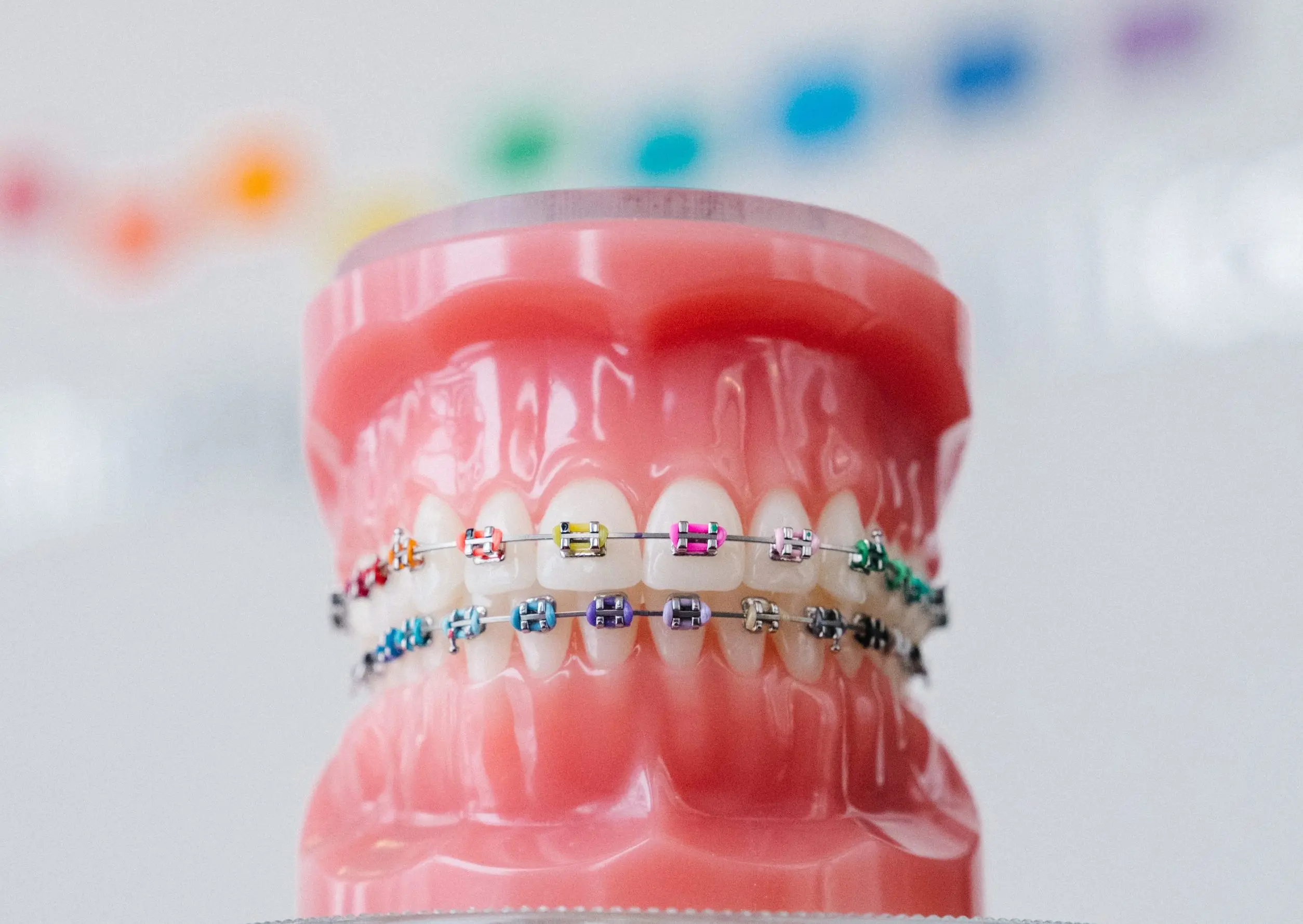 Dental model showing teeth with colorful braces on upper and lower rows.