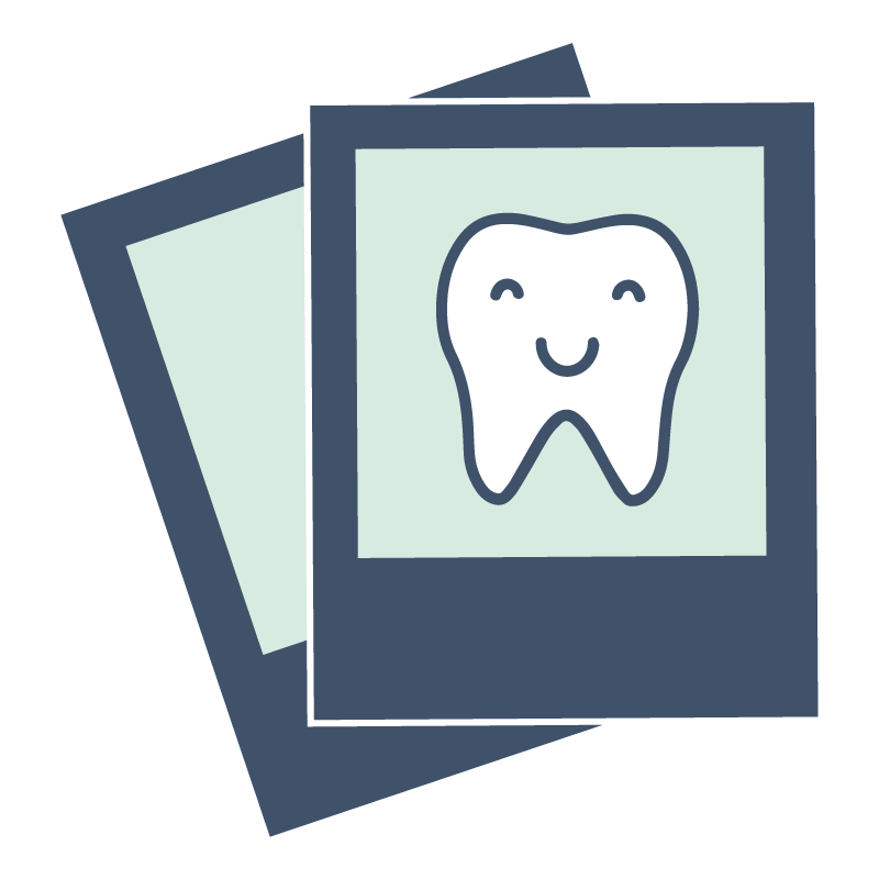 Two overlapping blue photo frames, front one showing a smiling white tooth illustration.