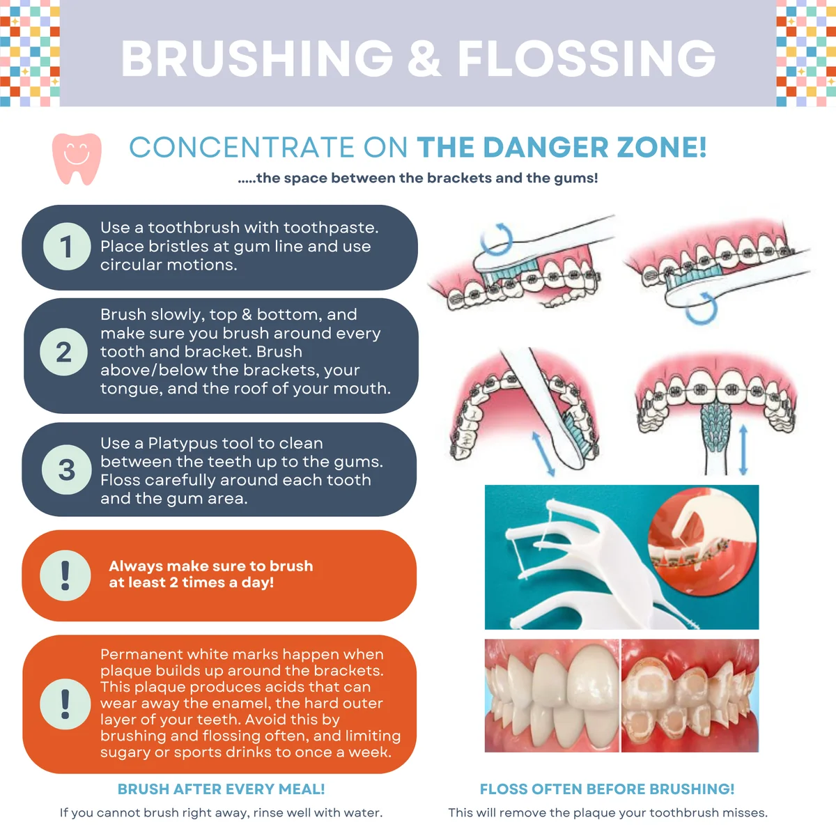 Schoettger Orthodontics brushing and flossing guide for braces patients, showing proper brushing technique and floss threader use