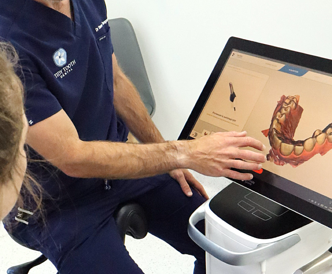 Next Smile All-on-4 Implants