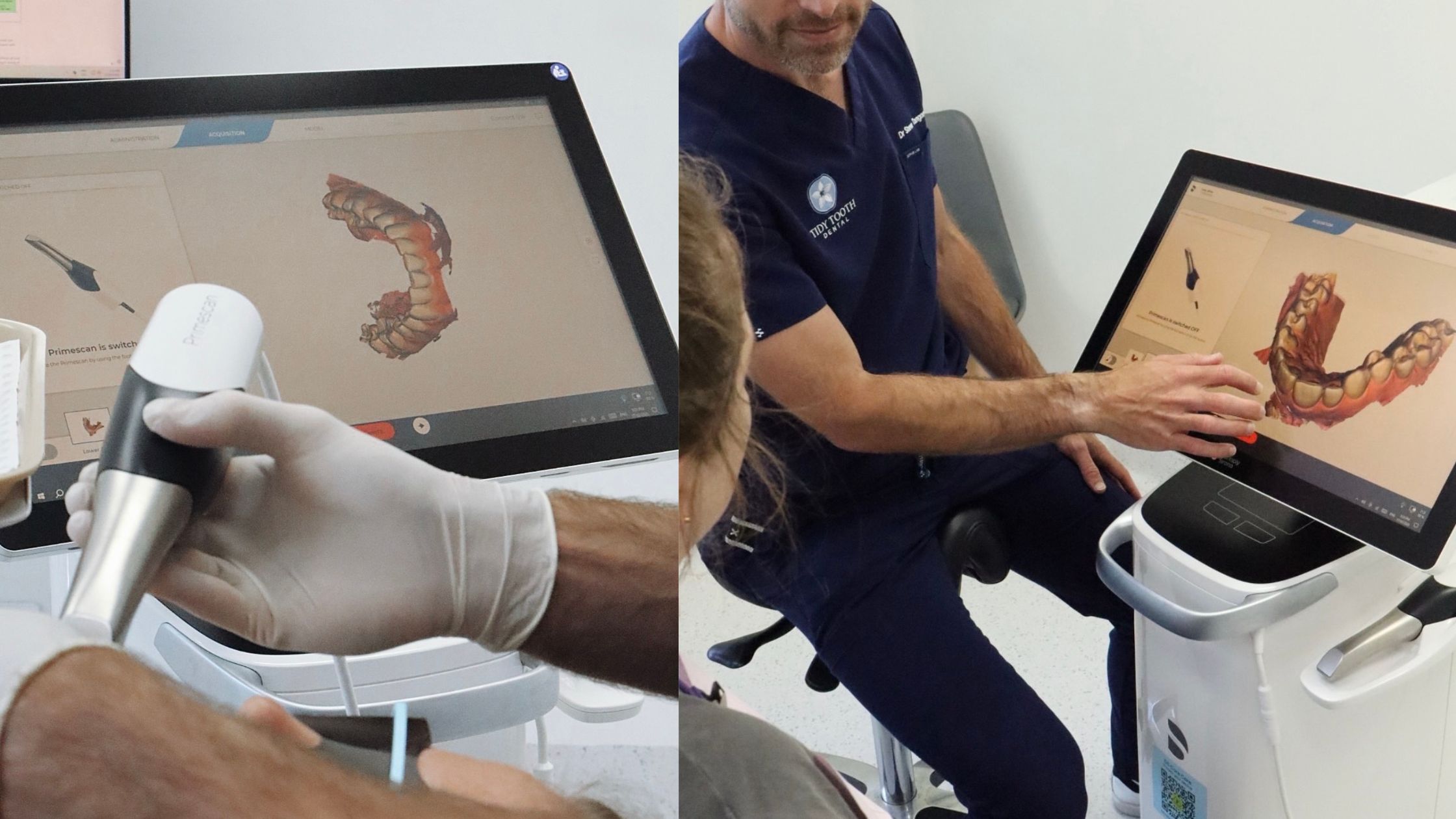 CEREC digital scanning and milling technology at Tidy Tooth Dental