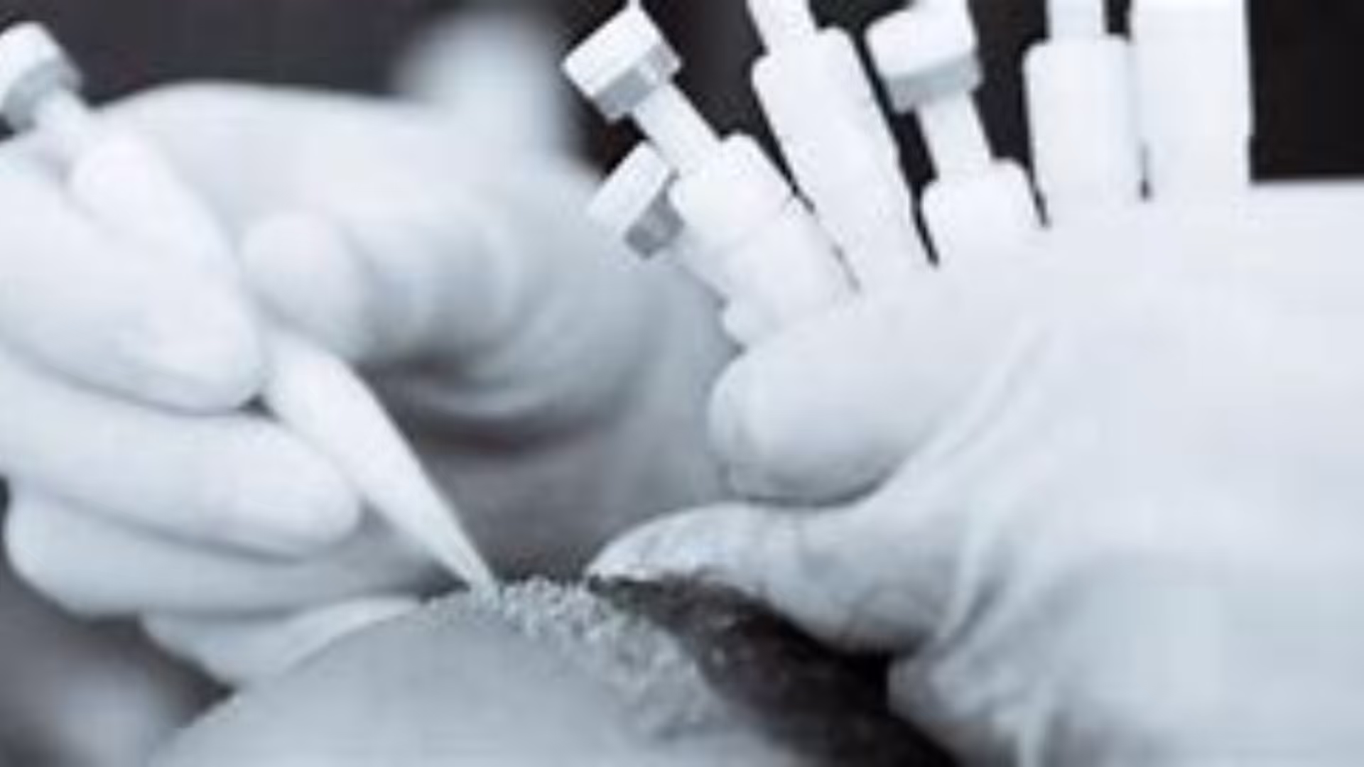 Direct Hair Implantation vs. FUE: What Sets It Apart?