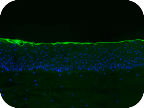 Healthy skin 3D culture