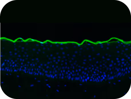Harlequin ichthyoses 3D skin 250nM KM-023