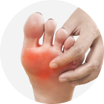 No disease-modifying therapies available 