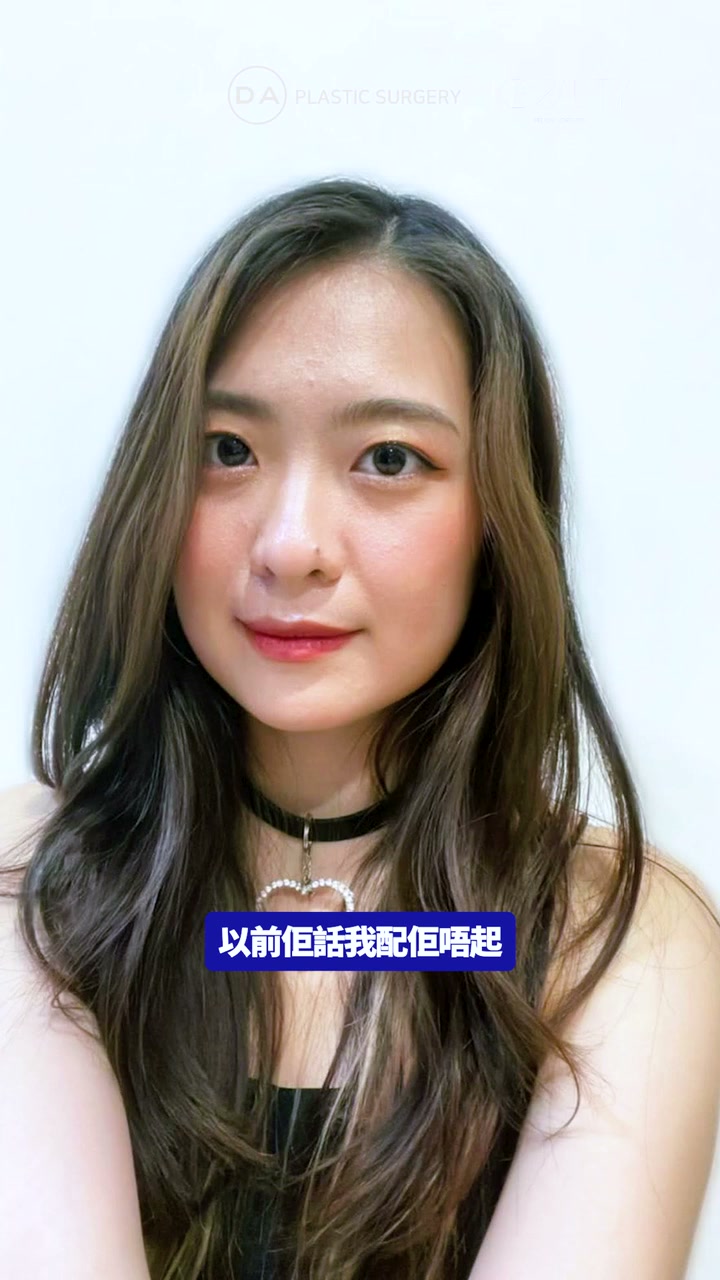 赴韓服務與術後經驗分享