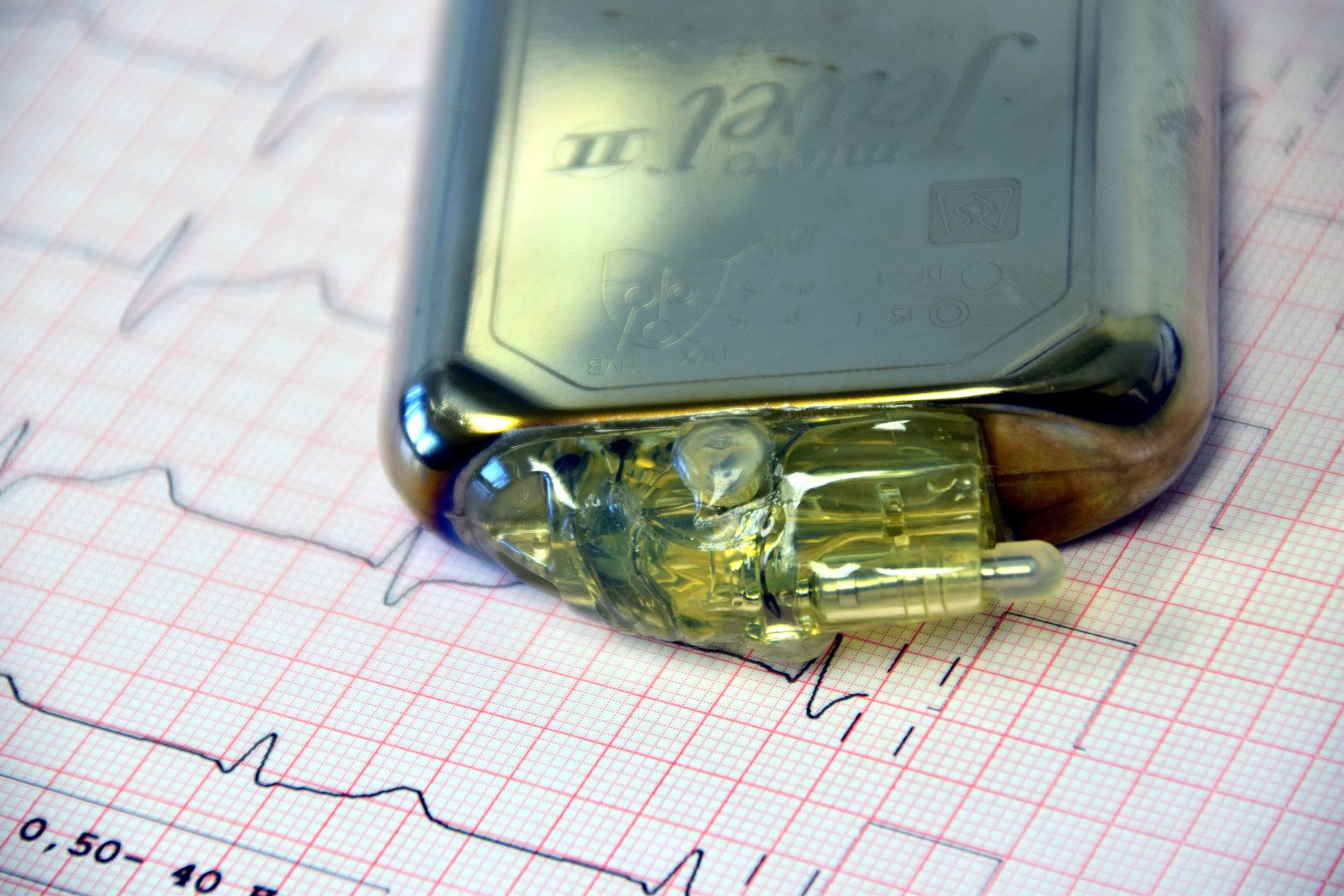 Cell Phones vs. Pacemakers & ICDs | Study supports risk of magnetic interference