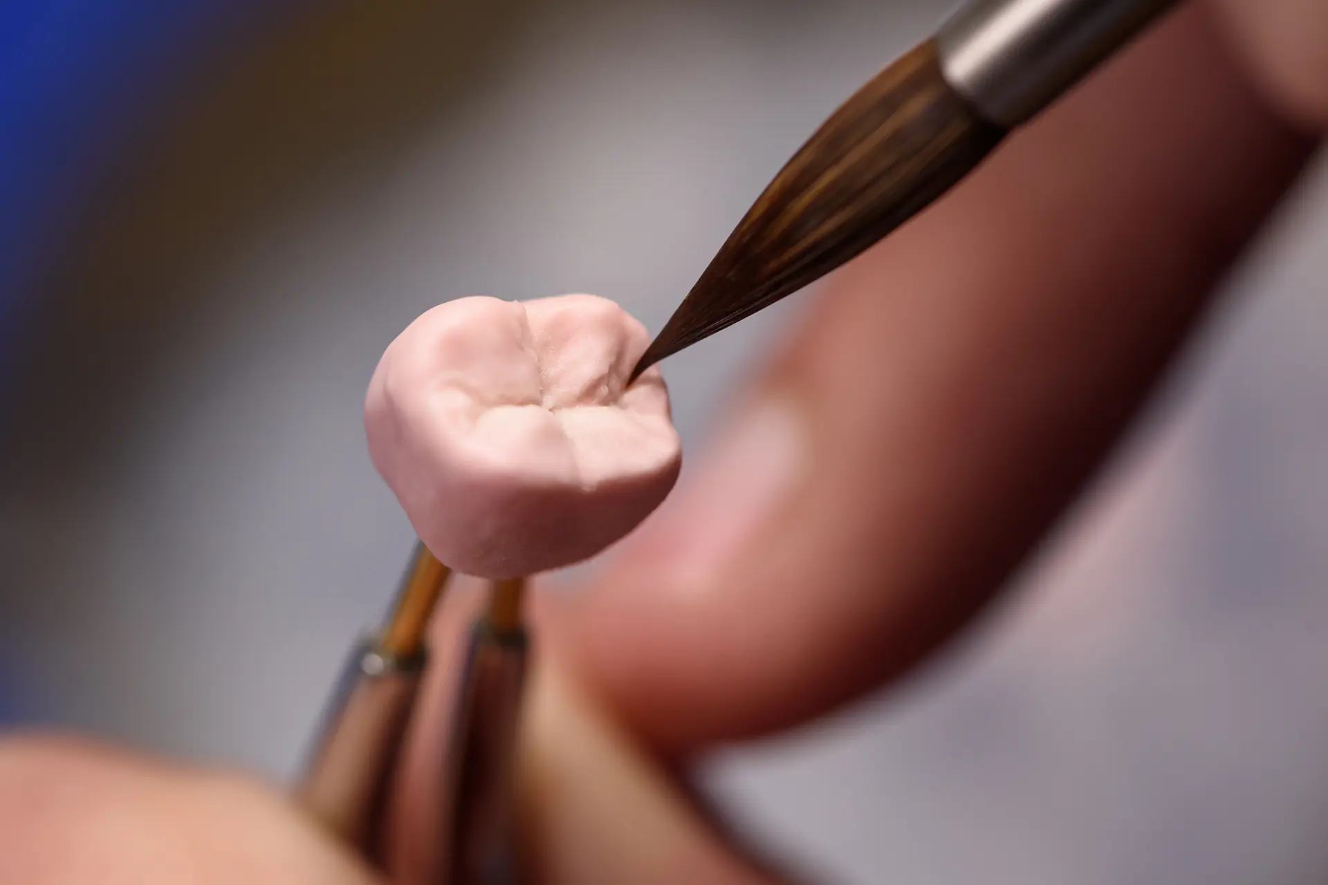 Implant Crowns