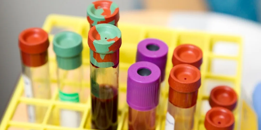 colorful capped laboratory blood collection tubes arranged in a yellow rack