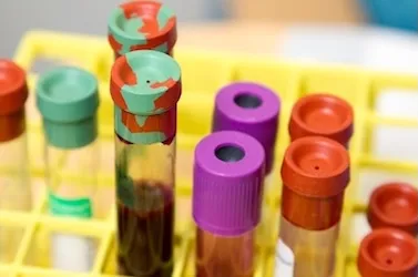 colorful capped laboratory blood collection tubes arranged in a yellow rack