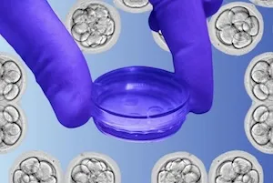 gloves holding stylized IVF growth dish