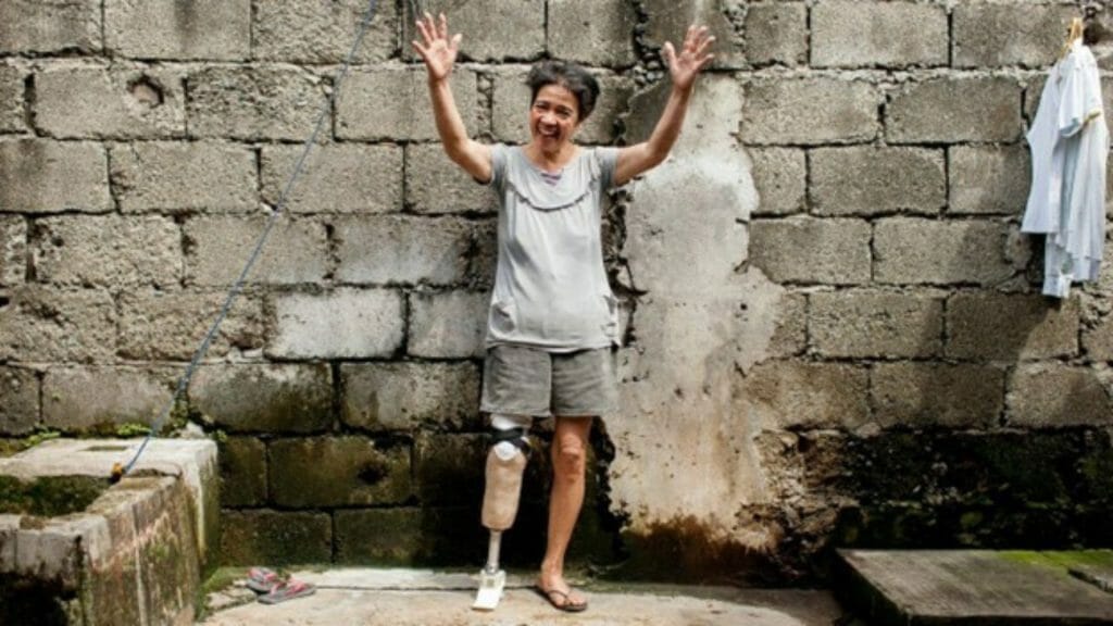 Image courtesy of LIMBS International