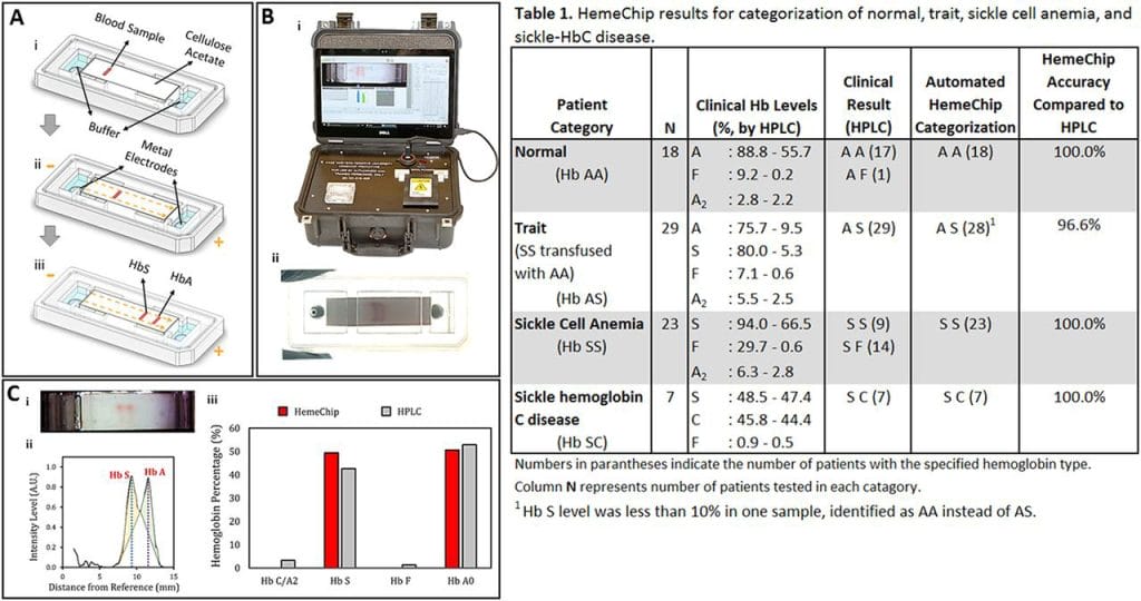 Image Credit: ScienceDirect HemeChip Test Analysis