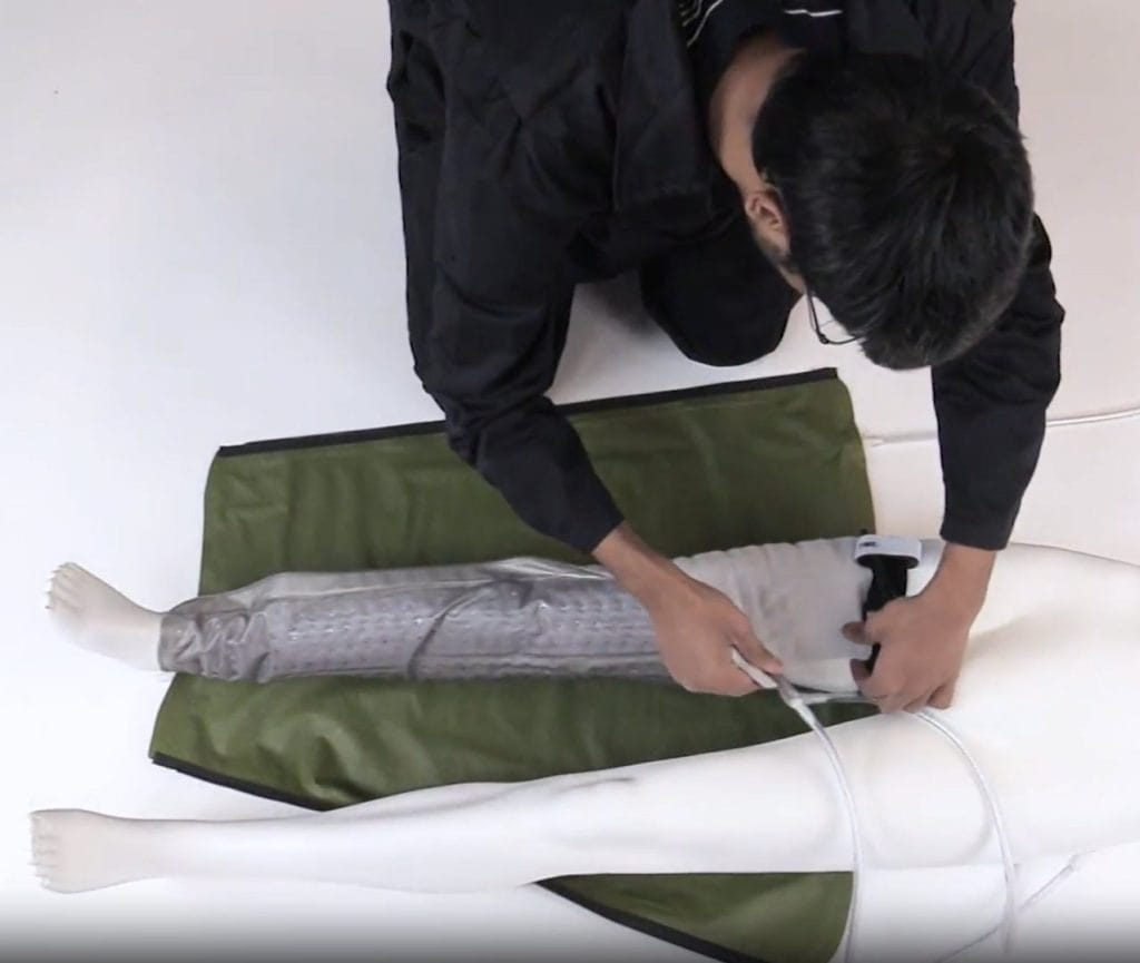 Image depicting a limb loss prevention device