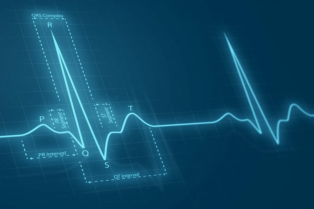 ecg circuit design