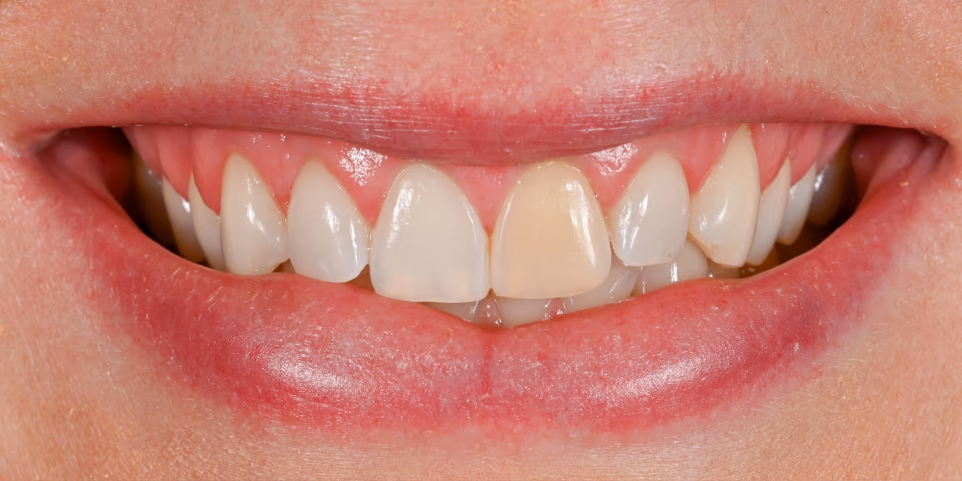 Before Image