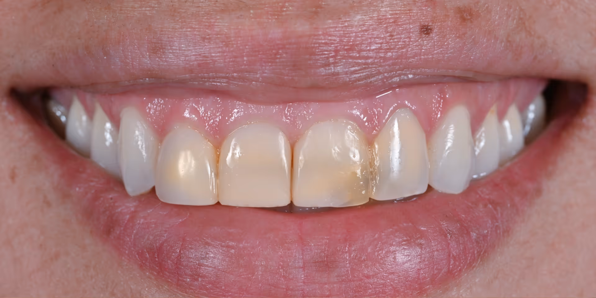 Before Image