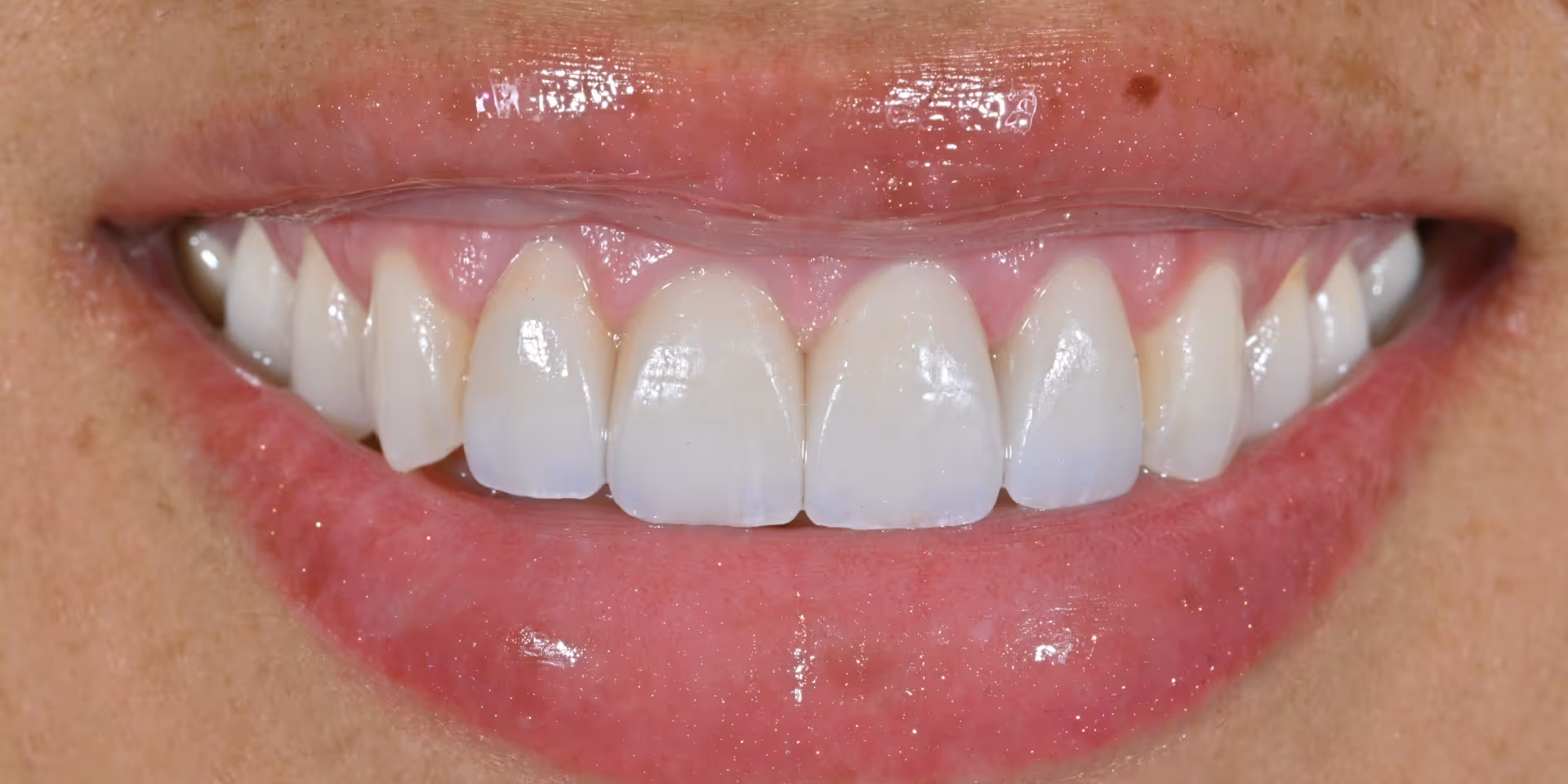 After Image
