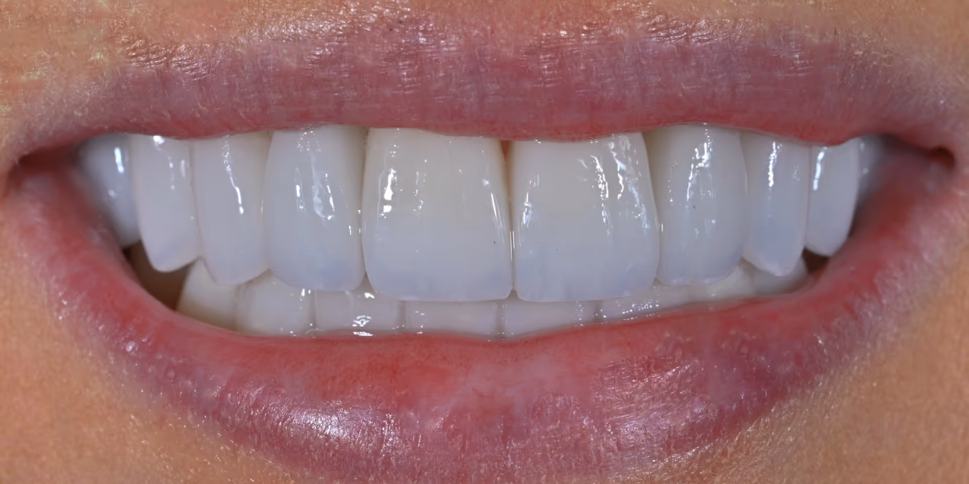 After Image
