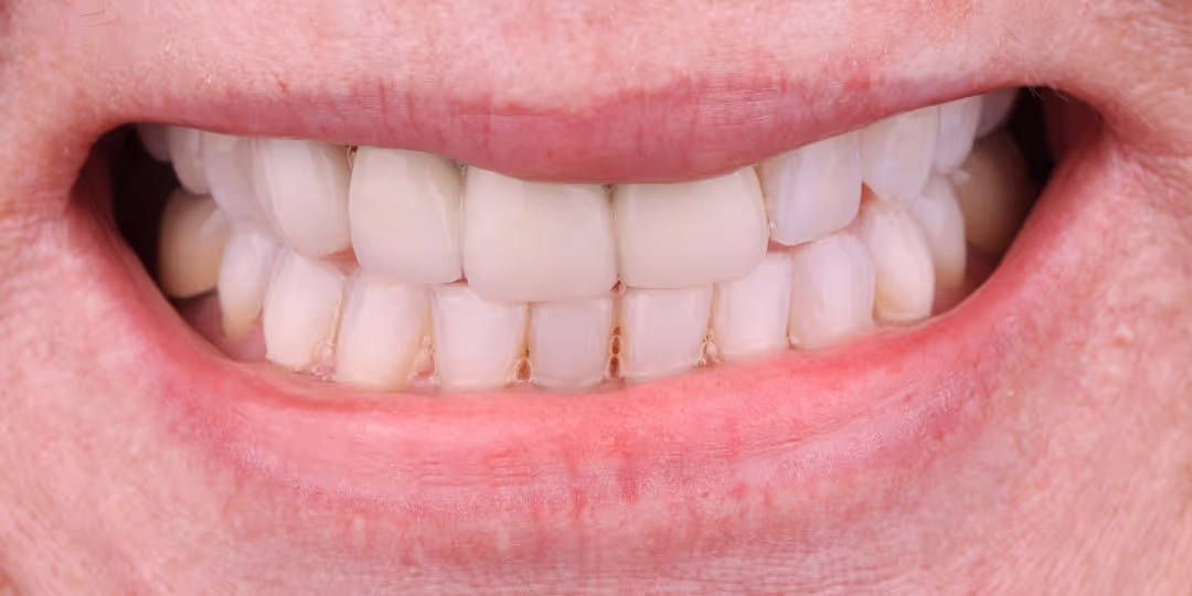 Before Image