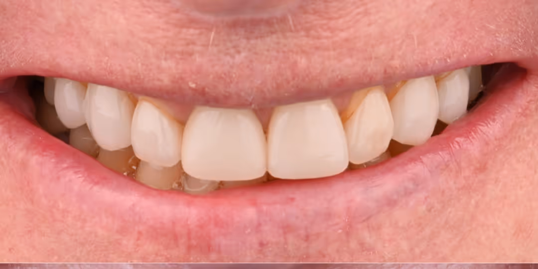 Before Image