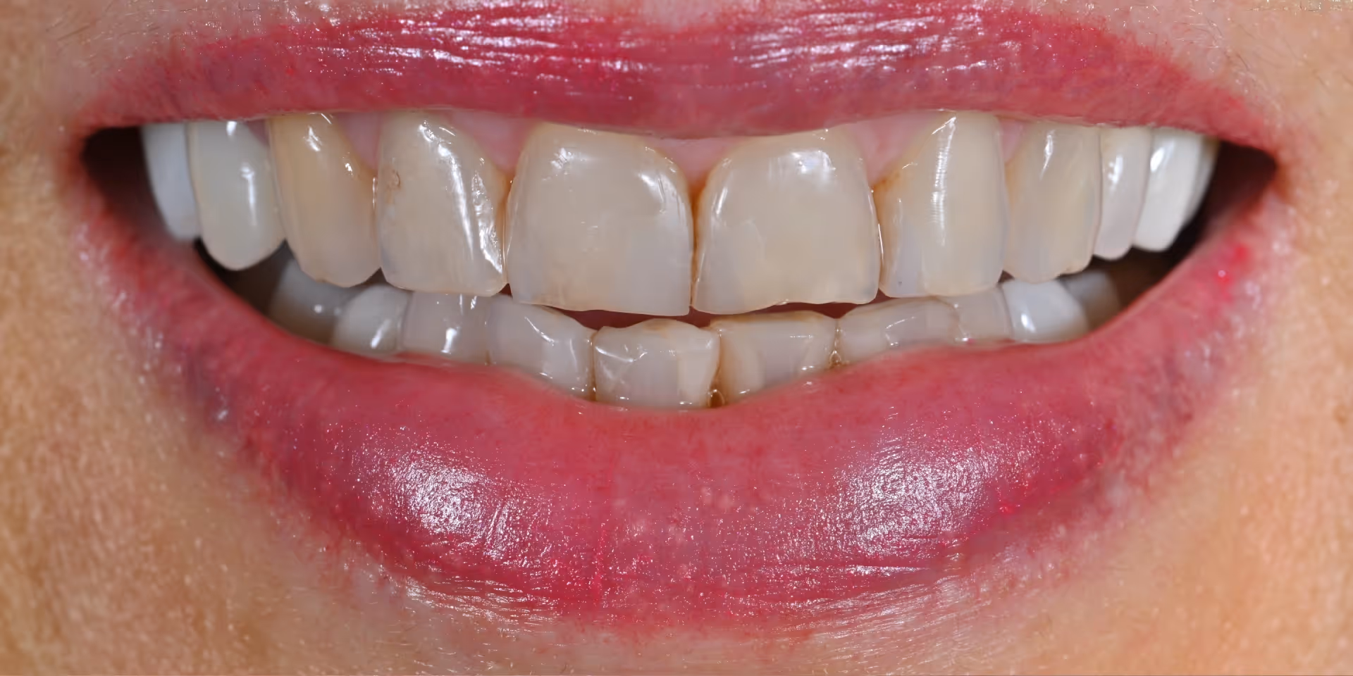 Before Image