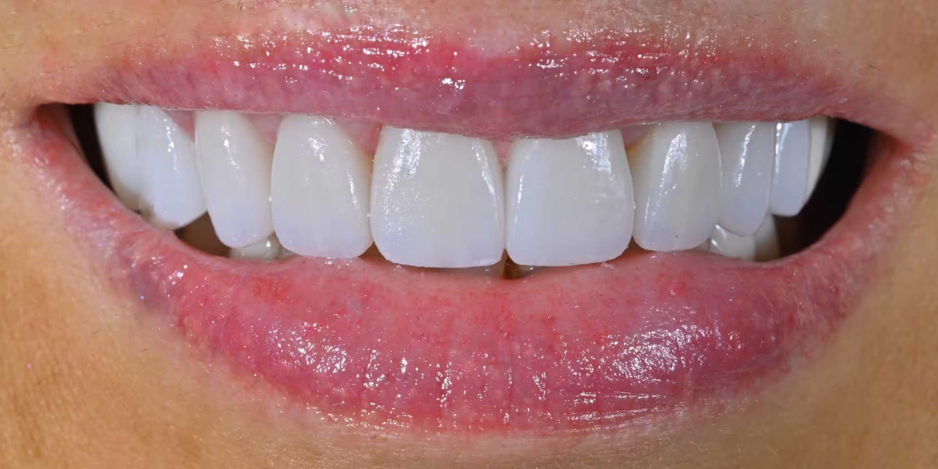 After Image