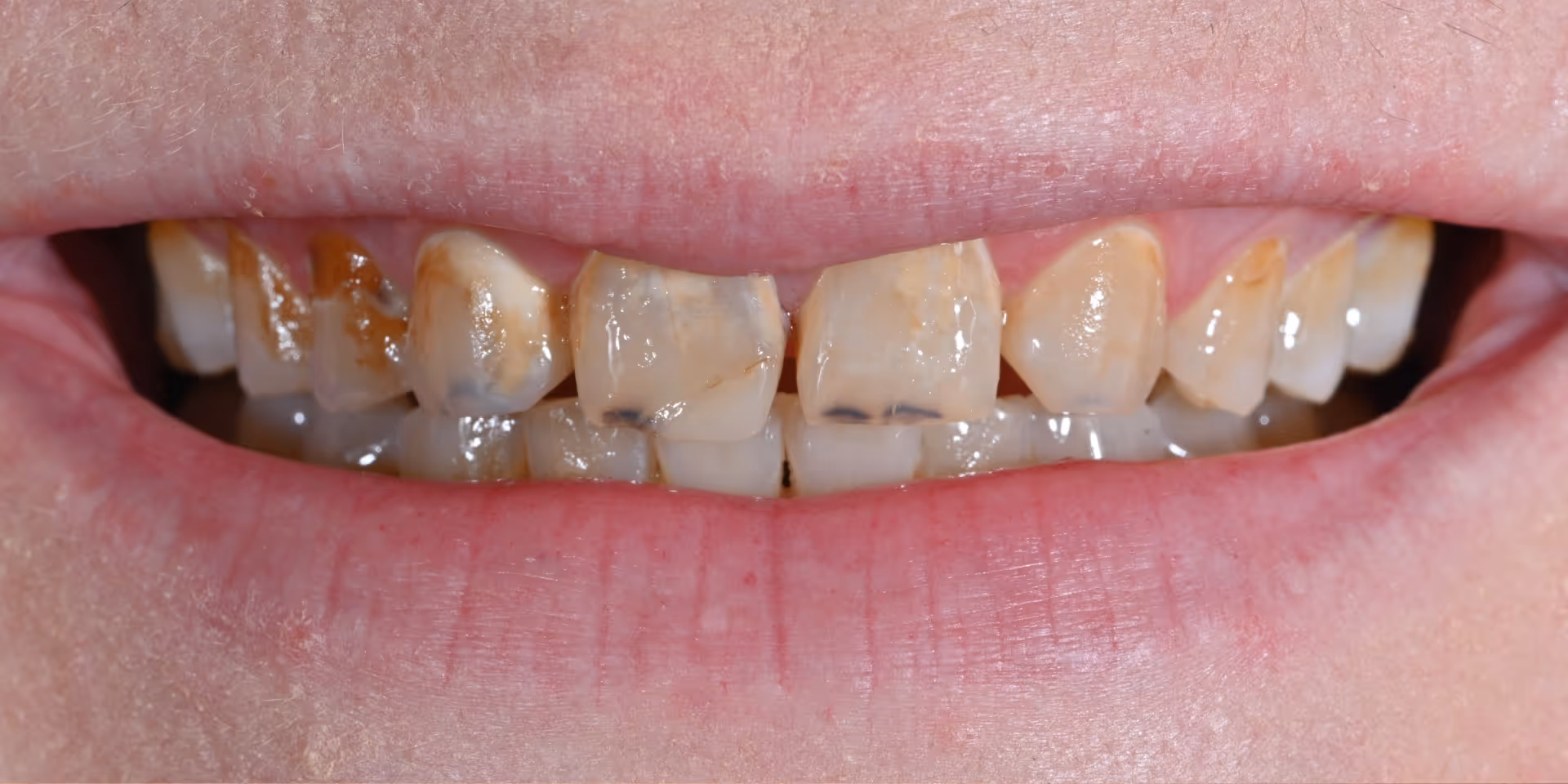 Before Image