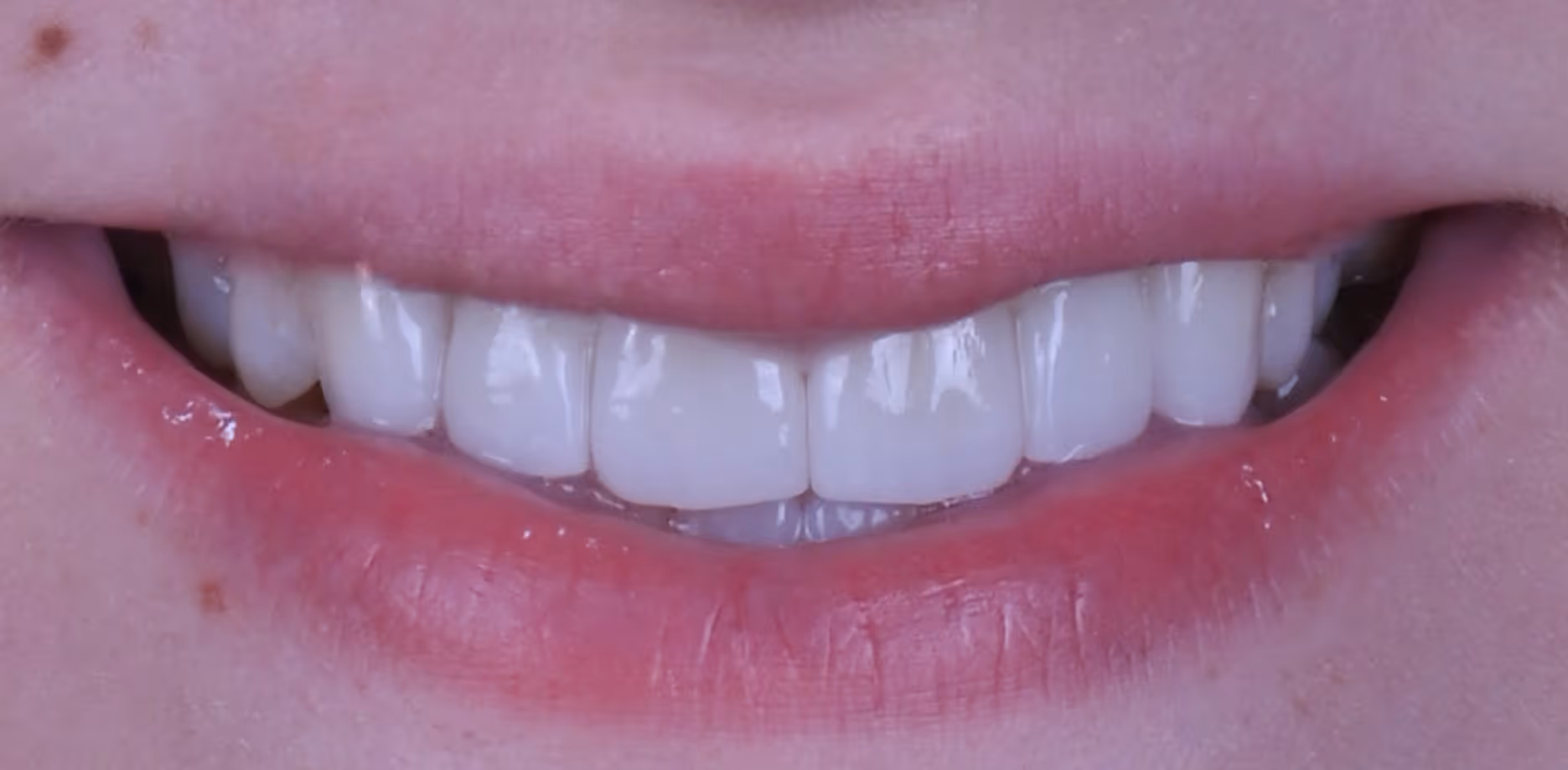 After Image