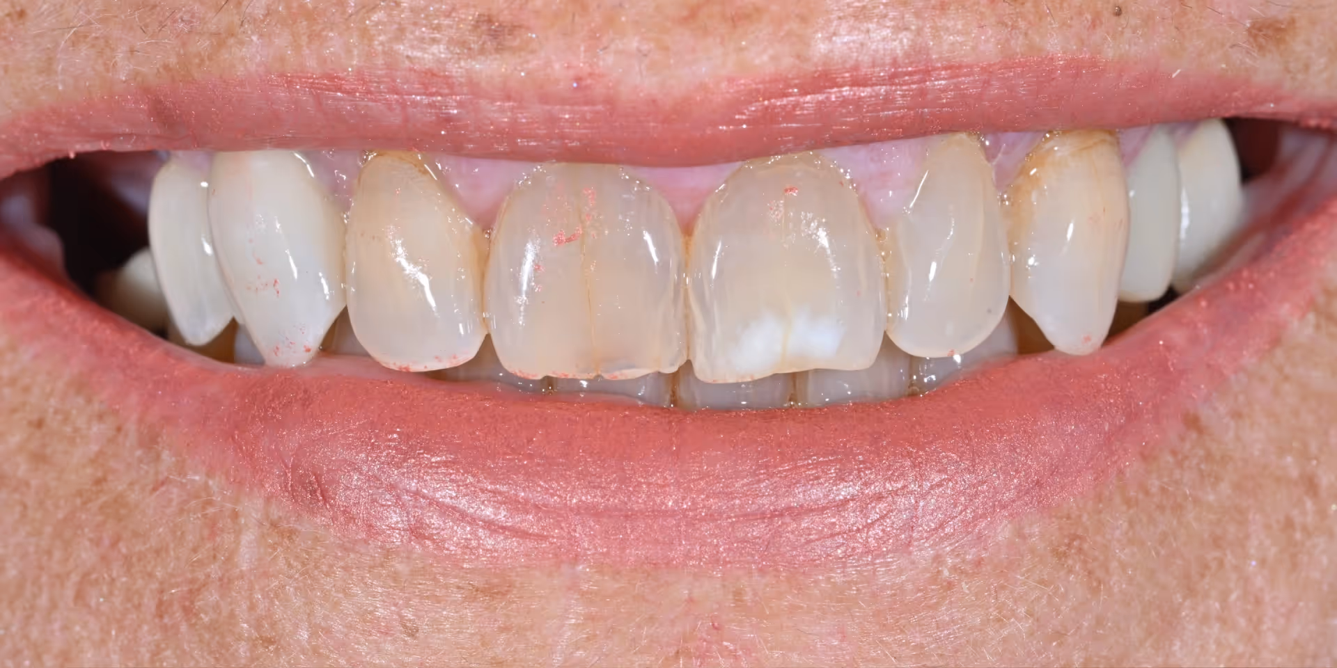Before Image