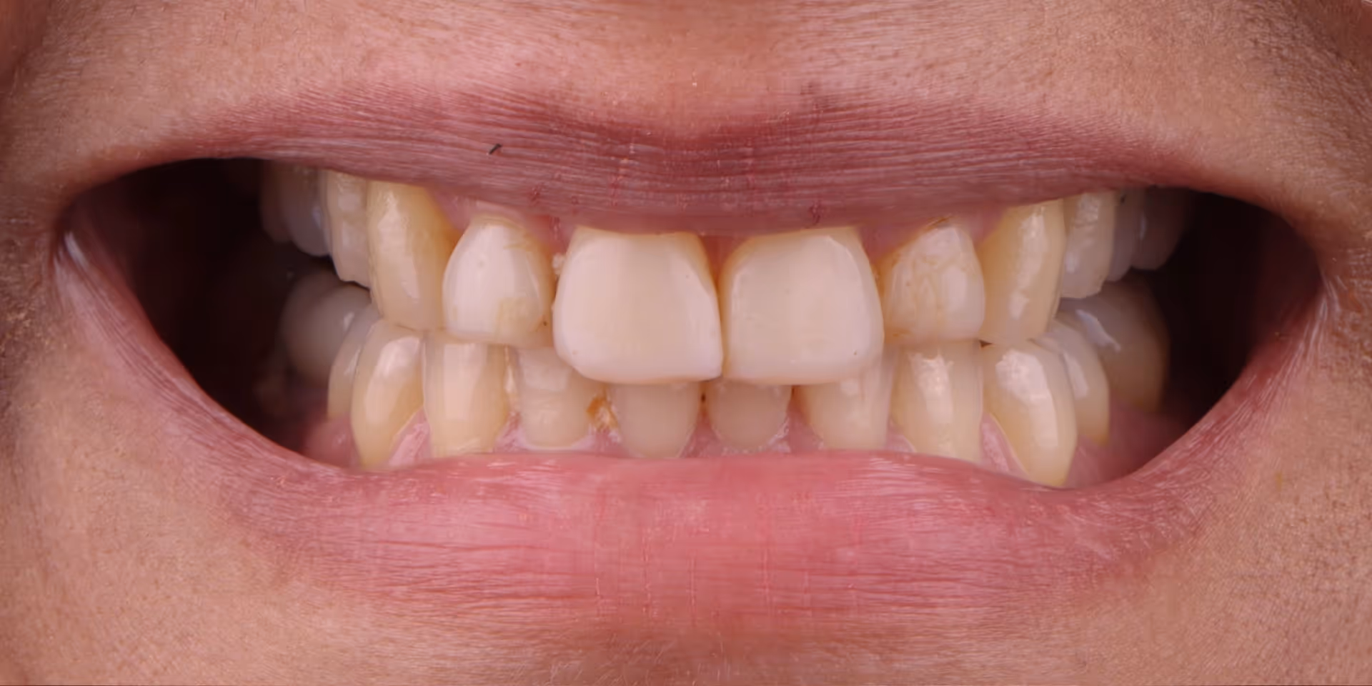 Before Image