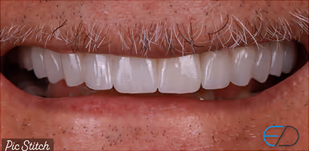 After Image