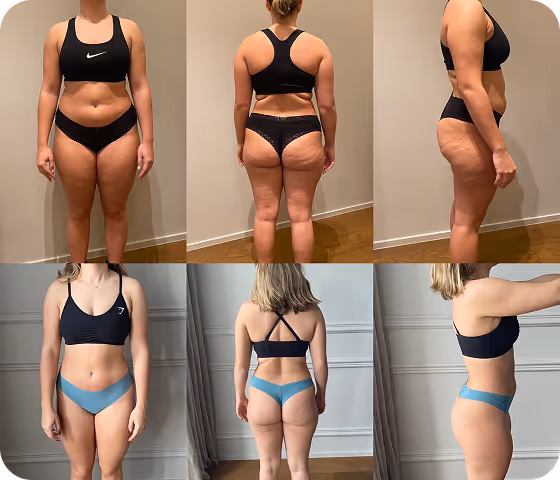 Before and after weight loss photos of a woman shown from front, back, and side views wearing black sportswear in the before images and blue sportswear in the after images.