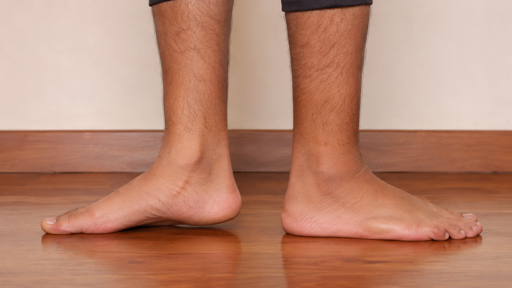 Bare feet standing on the floor, one with a visible low arch, illustrating flat feet.
