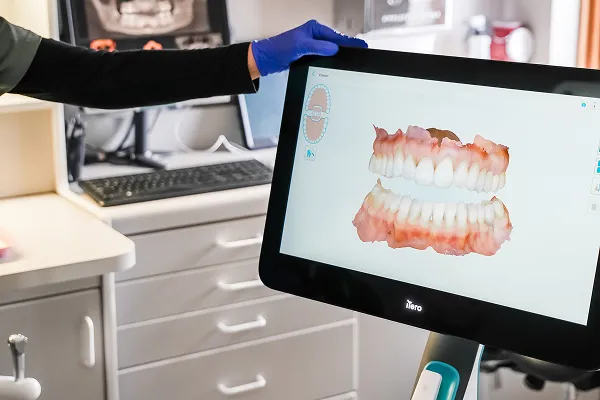 Gloved hand holding a dental 3D scanner displaying a digital model of upper and lower teeth on the screen.