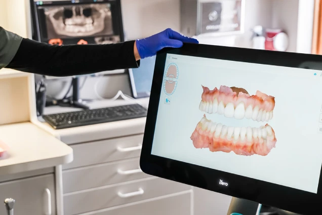 Invisalign - Benefit 2