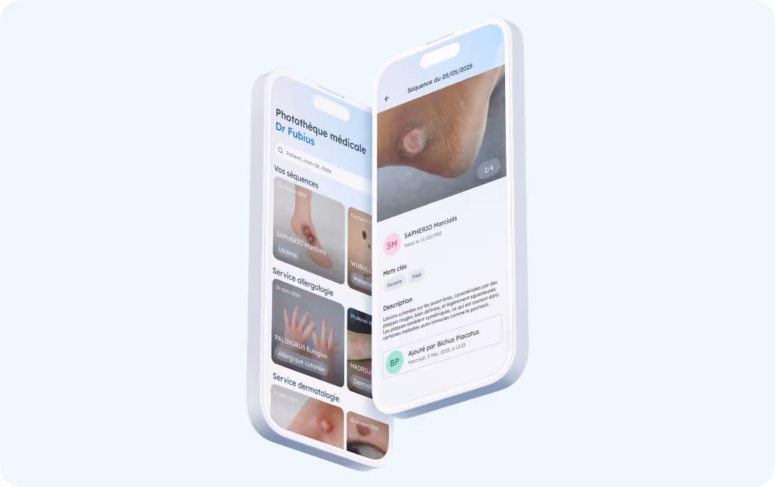 Two white smartphones displaying the Pixacare medical photo library application with images of skin lesions and their detailed descriptions.
