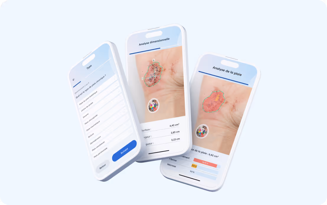 Trois smartphones affichant l'application Pixacare d'analyse de plaie avec sélection du type de plaie, mesure dimensionnelle et analyse visuelle de la plaie.