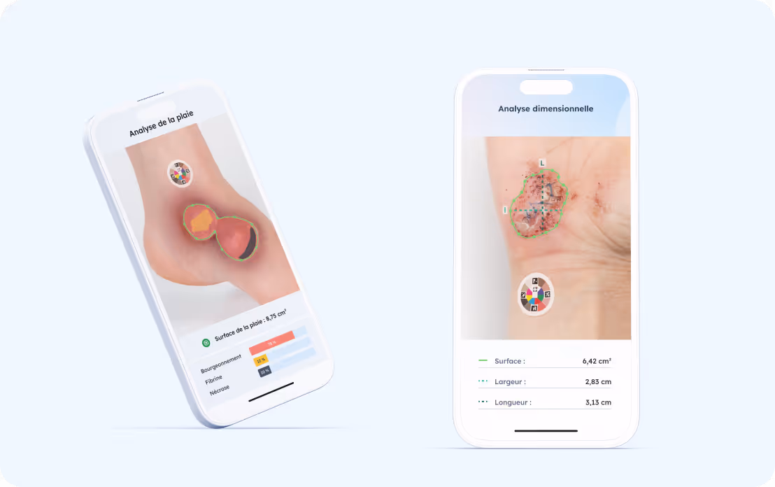 Two smartphones displaying the Pixacare wound analysis application with area, width and length measurements on images of injured skin.