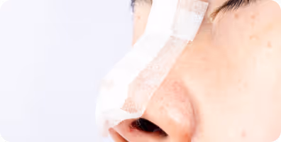Close-up of a face with a medical bandage on the nose, indicating plastic or reconstructive surgery.