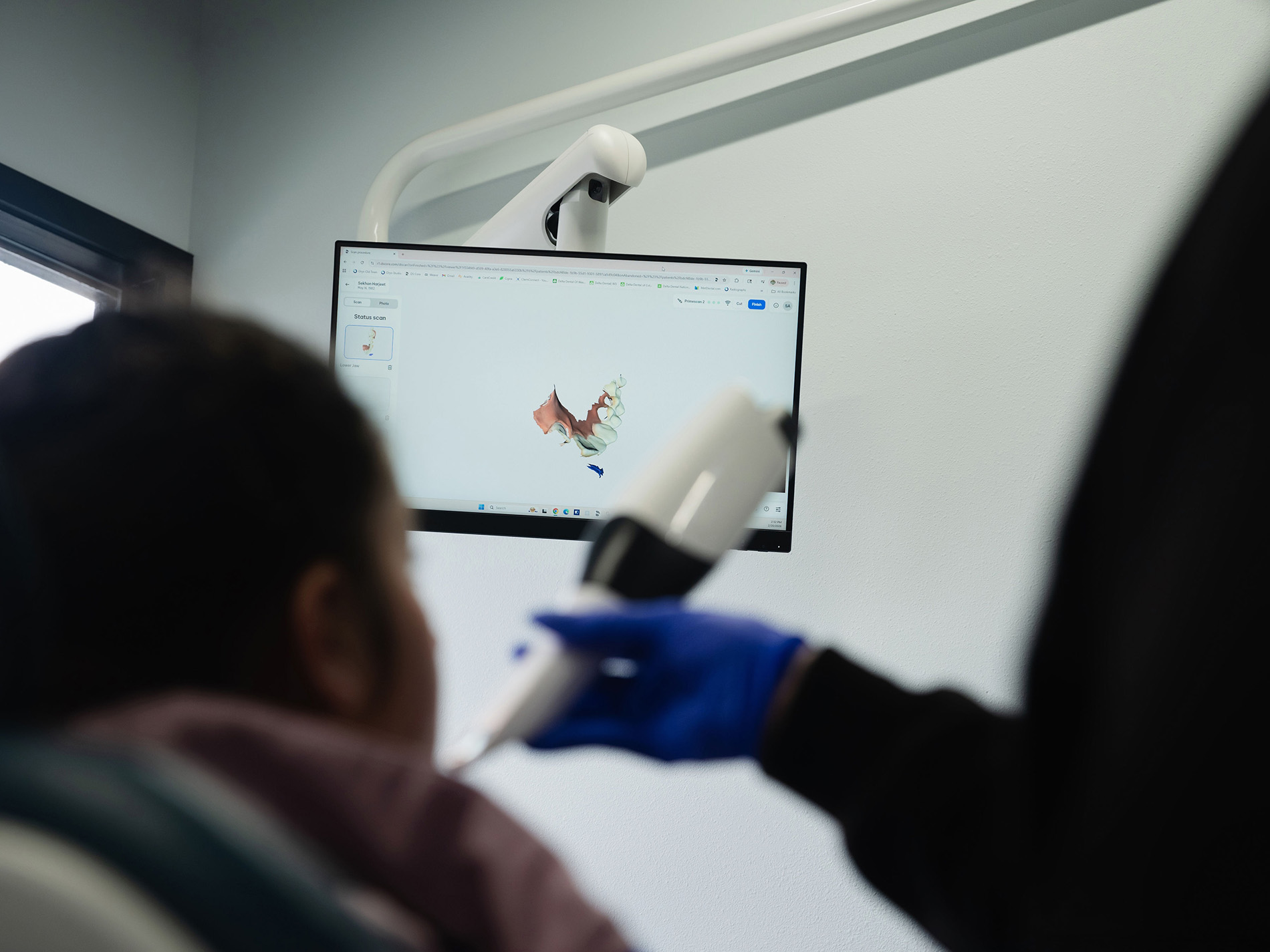 Dental professional using intraoral scanner as patient views 3D dental image on monitor.
