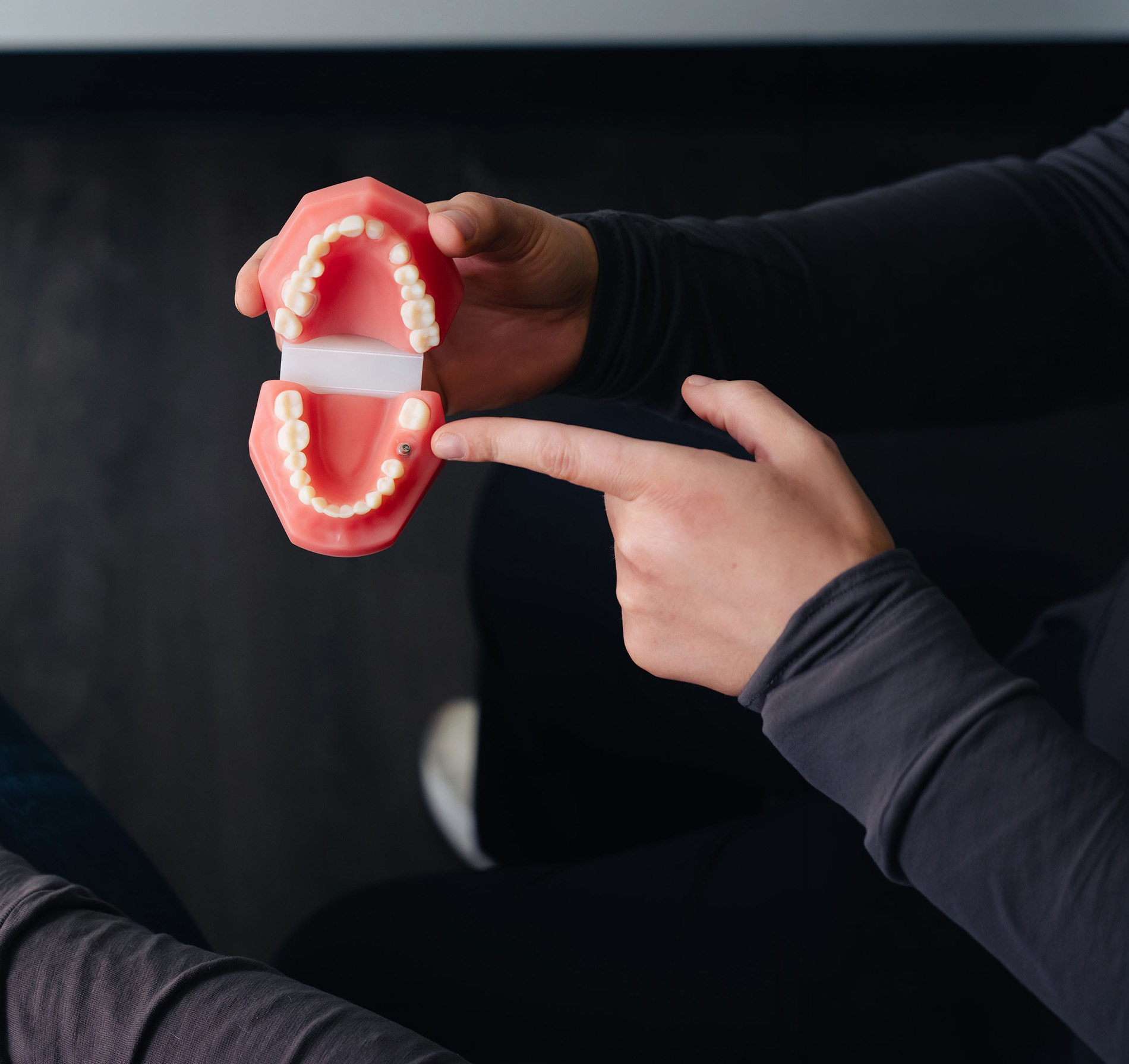 Hands holding dental model showing teeth and pointing at dental implant on lower jaw.