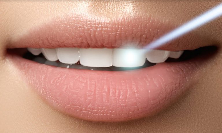 Defiance Dental Studio Tacoma - Tacoma