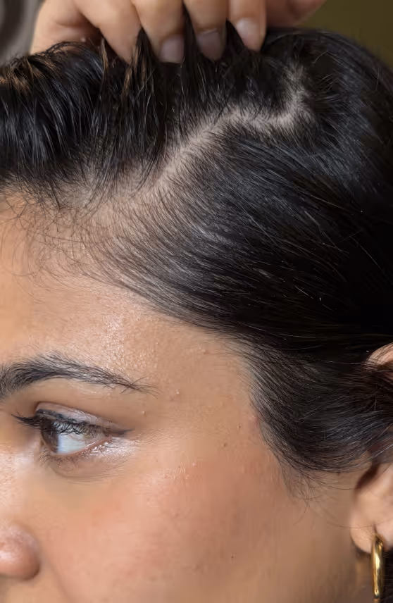 Megha